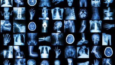 KÜSIMUS EKSPERDILE | Kui sageli tohib röntgenis käia?