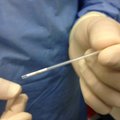 34-aastane sakslane sai püsiva erektsiooni, mille järel amputeeriti peenis ja jalg