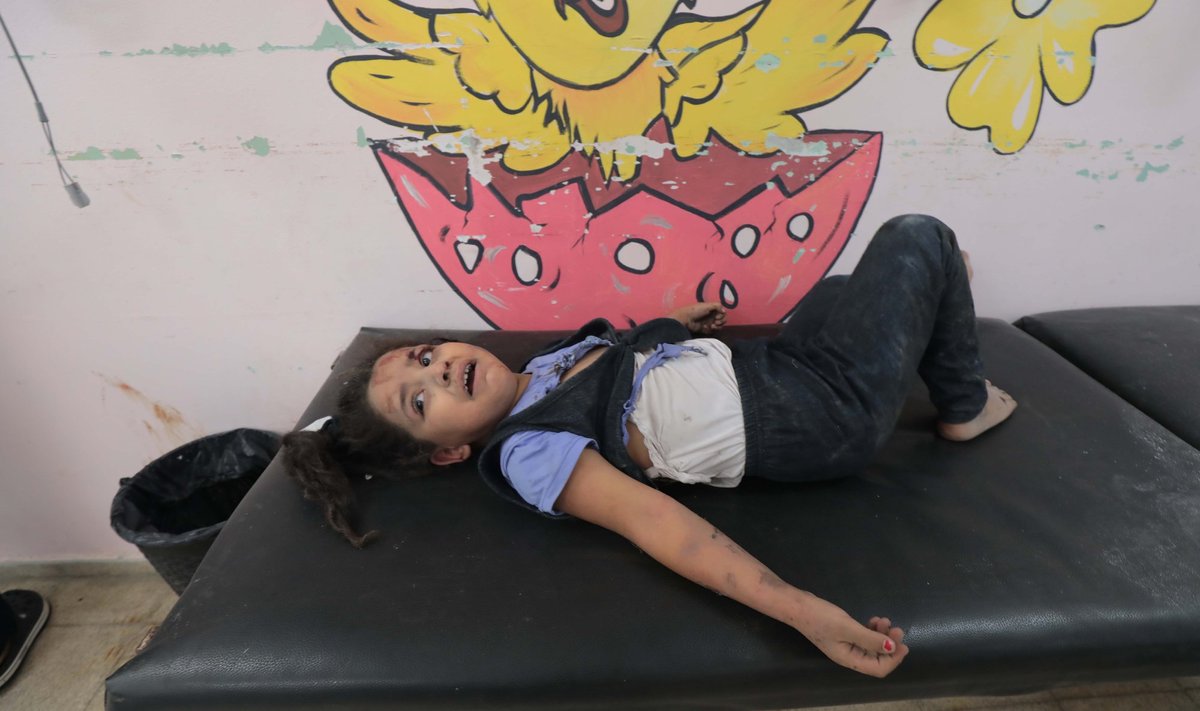 Gazas Iisraeli õhurünnakus viga saanud laps