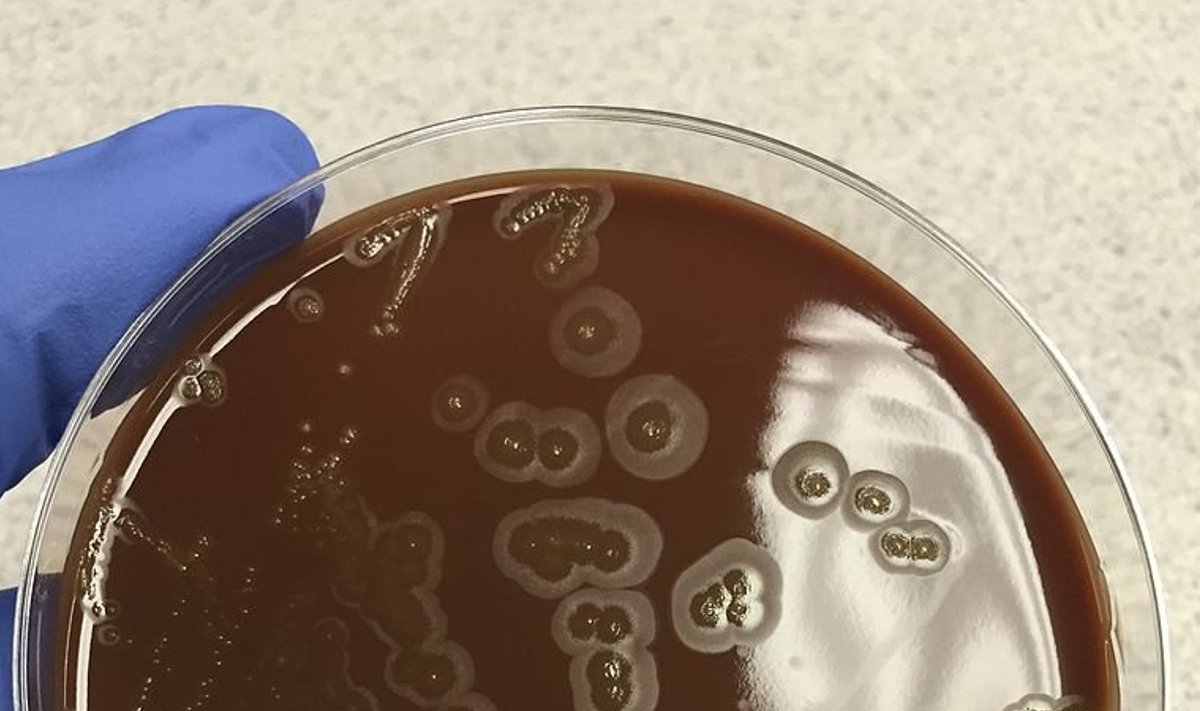 Illustratiivse tähendusega pilt bakteritest, mis on tegelikult laboris kasvanud  (Foto: Wikimedia Commons / Deminorwood)