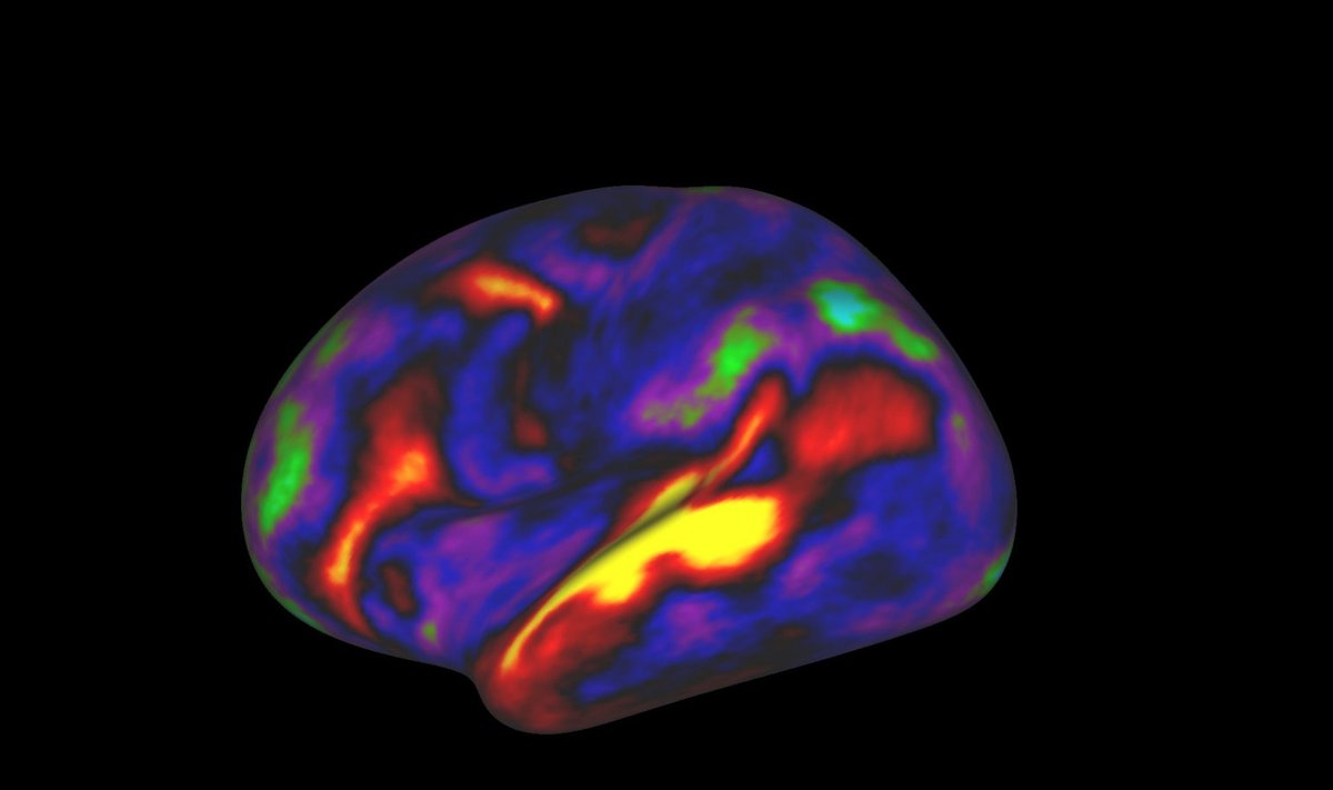 Punased ja kollased ajuosad magnetresonantstomograafi all on parasjagu aktiivsed. Pilt pole artiklis kirjeldatud uurimusega seotud.