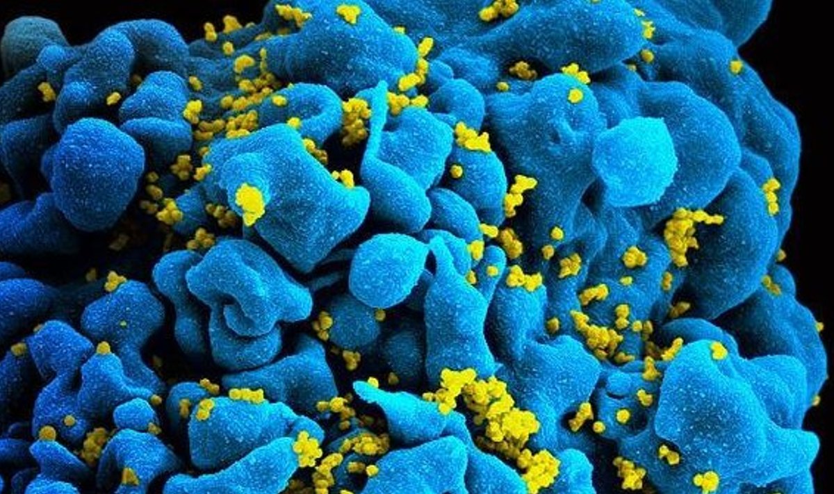 Foto: USA riiklik terviseinstituut (HI-viirusega nakatunud immuunrakk)