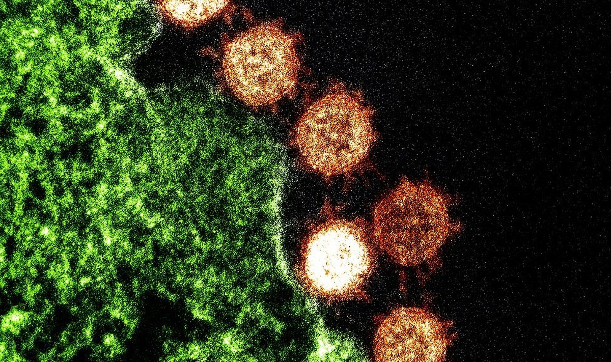 SARS-CoV-viirus (Foto: Wikimedia Commons / NIAID)