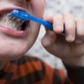 Tõenäoliselt pesed sa oma hambaid valesti! Tuletame meelde, kuidas seda õigesti teha