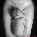 Südamlik ja jõuline FOTO: Jäädvustus keisrilõike armist, mis väikese beebi elu päästis