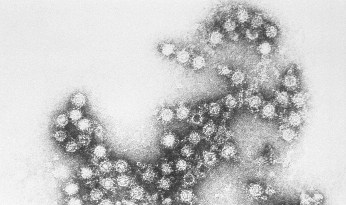Coxsackie-viirus mikroskoobi all