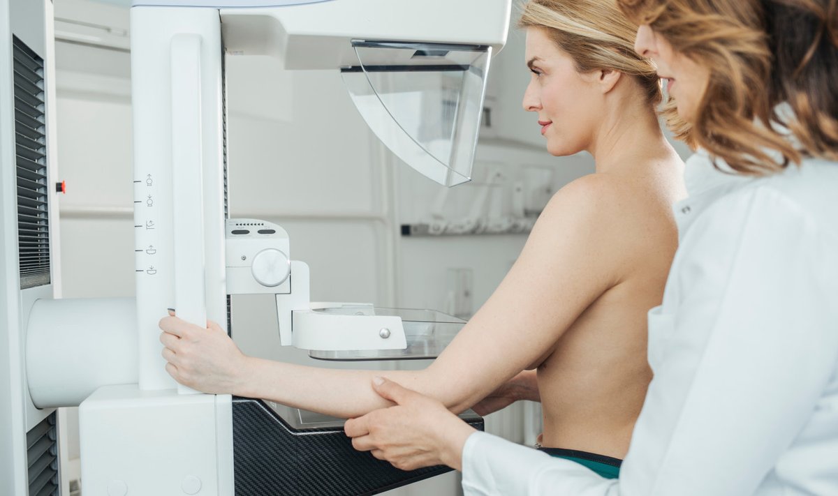 Sõeluuringu käigus kasutatakse rinnanäärme radioloogilist uuringut ehk mammograafiat. Mammograafiauuring tähendab, et rindadest tehakse röntgeniülesvõtted.  Uuringus osaleja juhatatakse aparaadi juurde, kus uuringut läbi viiv radioloog asetab rinnad kordamööda kahe lameda plaadi vahele ja teeb pildid kummastki rinnast.