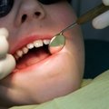 KÜSITLUS | Kui palju hambaraviteenused tegelikult maksavad?