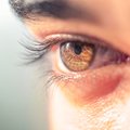 „Мушки“ перед глазами: врач-офтальмолог объяснил, когда нужно волноваться
