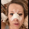 Беда не приходит одна: Ксения Собчак сломала нос