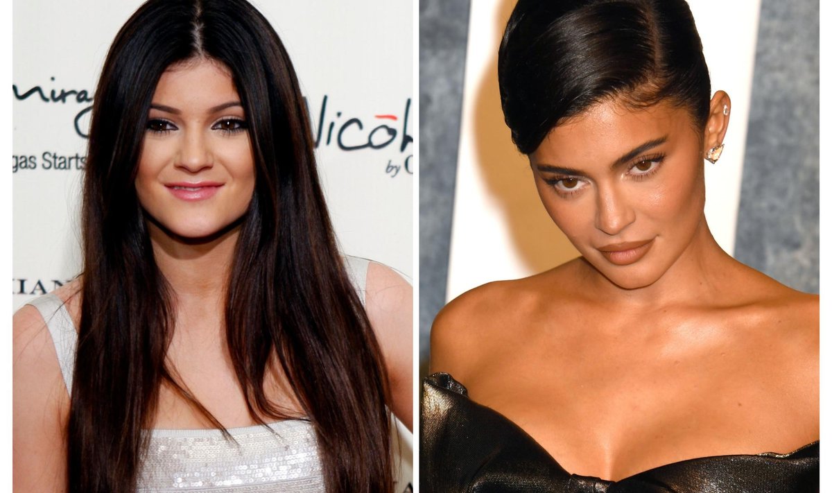 Kylie Jenner teismelisena ja nüüd.