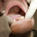 Ravimata hammastega inimesed satuvad surma veerel olles intensiivravisse