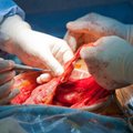 Poola kirurgid lõikasid patsiendil välja vale neeru
