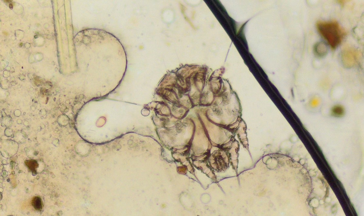 Sügelislest mikroskoobi all. (Foto: laboratorio diagnostica ancona IZSUM/(CC BY 2.0))