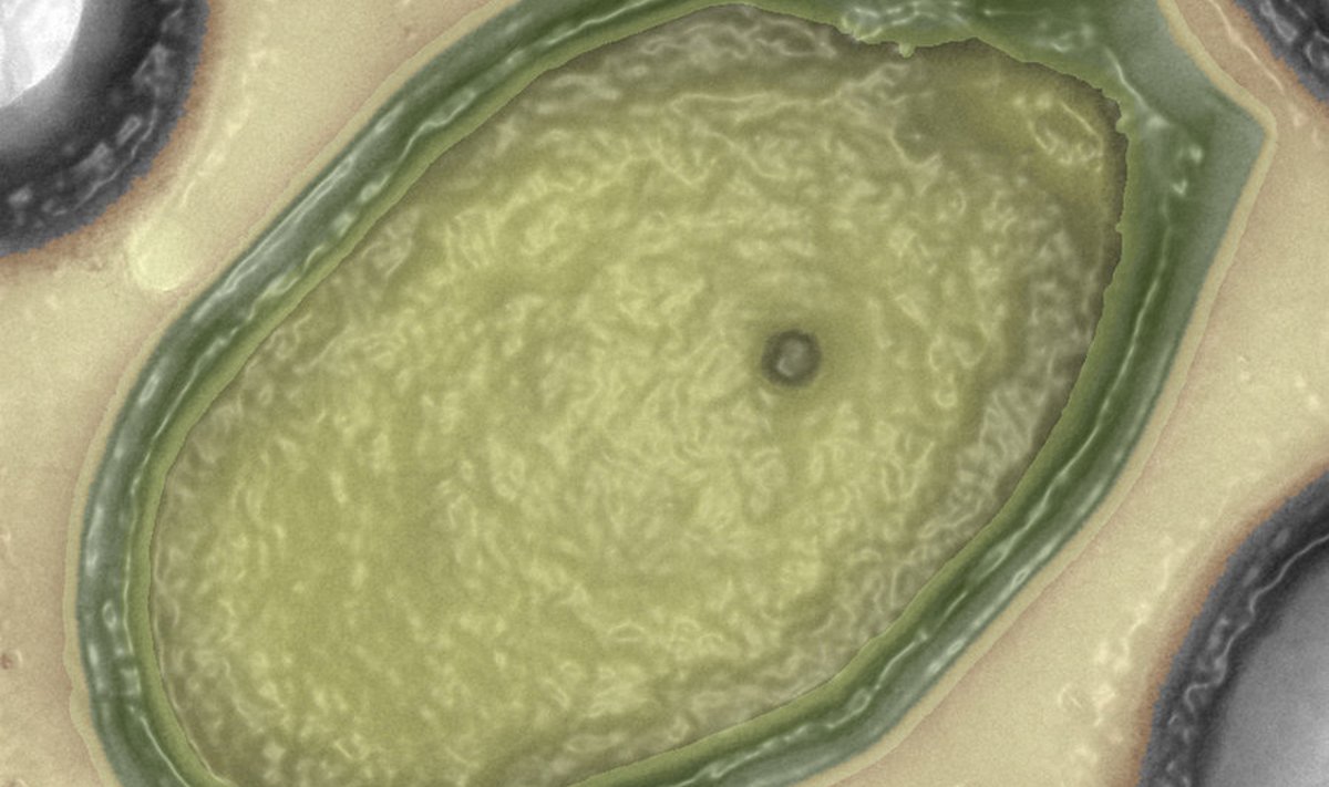 Hiigelsuured pandoraviirused on nähtavad tavalise valgusmikroskoobiga. Foto: C. Abergel/J.-M. Claverie / npr.tumblr.com