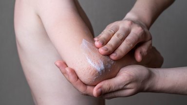 Psoriaas, dermatiit, akne – kuidas hoolitseda probleemse naha eest külma ja tuulise ilma saabudes 