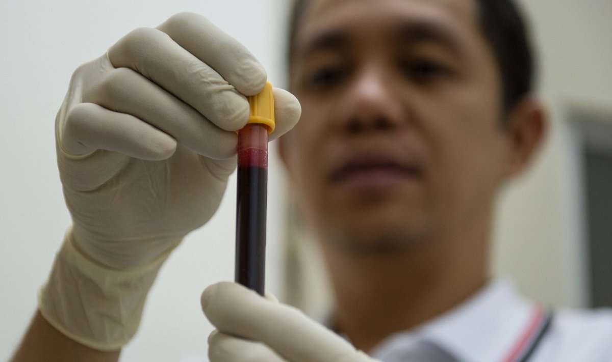 HIV-i testimine. (Foto: AFP)