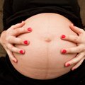Kas naine, kes pole sünnitanud, peaks laskma kõhult sünnimärgid eemaldada?