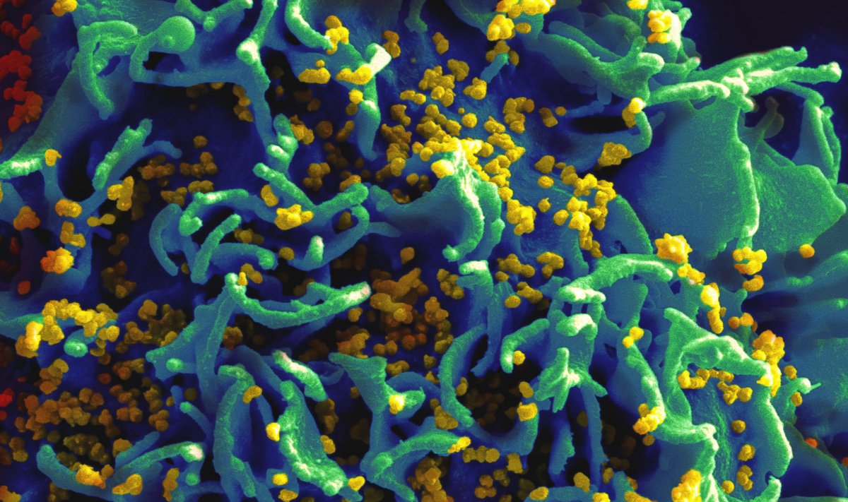 HIVga nakatunud H9 T-rakk (Wikimedia Commons / USA riiklik terviseinstituut NIH)
