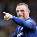 FOTOD | Wayne Rooney sai hirmuäratava silmavigastuse