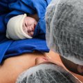 Ämmaemandad komplikatsioonidest: verejooks, õlgade düstookia ja teised ootamatused, millest enne sünnitust teadlik olla võiksid