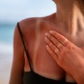 Правила ухода за кожей после солнечных ванн – вы забываете об этом