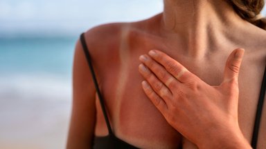 Правила ухода за кожей после солнечных ванн – вы забываете об этом