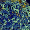 Vaenlane: HIV kinnitab organismis kanda vähem kui kolme päevaga