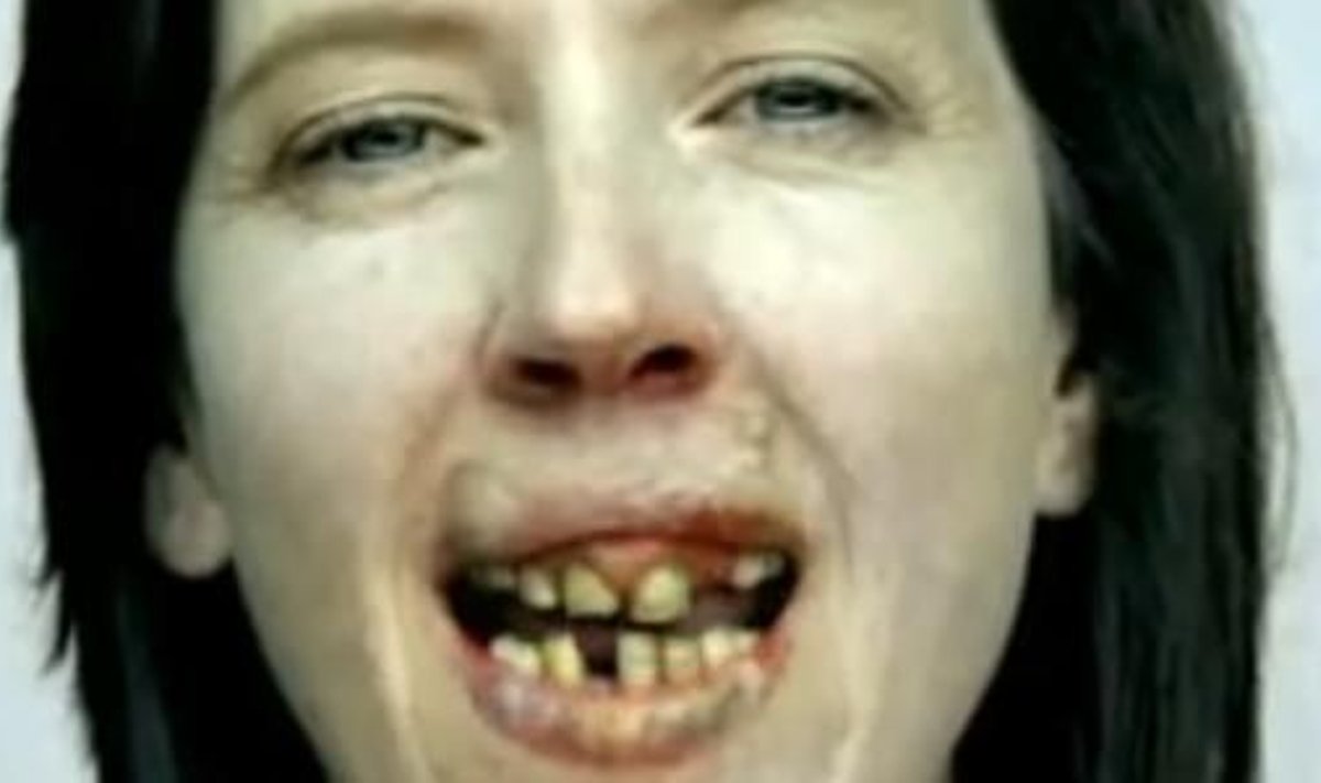 Suitsetamisest rikutud hambad. Austraalia suitsetamisvastane reklaam. YouTube