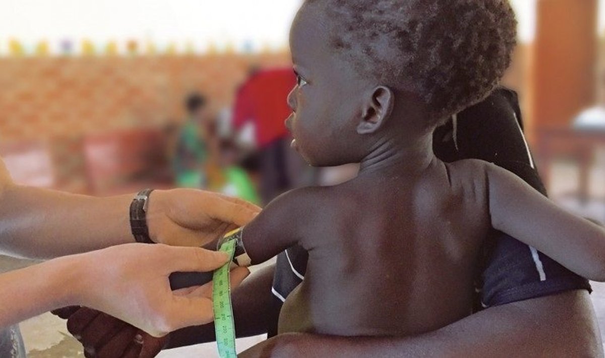 Alatoitumuse all kannatav Malawi laps. (Foto: Lucy Bollinger/Washingtoni ülikool)