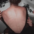 Rikutud armuakt: mis võib põhjustada seksimisel tekkivat valu?