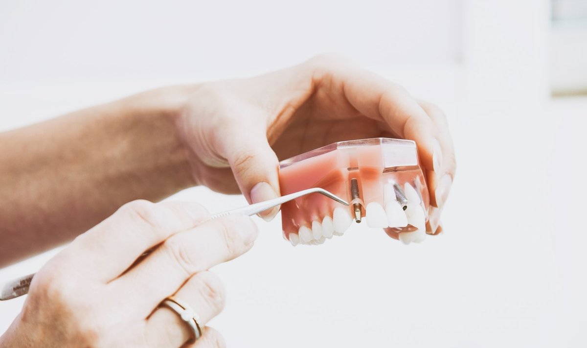 Tervete hammaste saladuseks on regulaarne hambaarsti külastus.