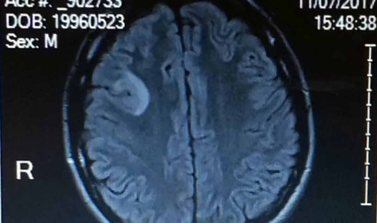 Magnetresonantstomograafi kujutis ajust