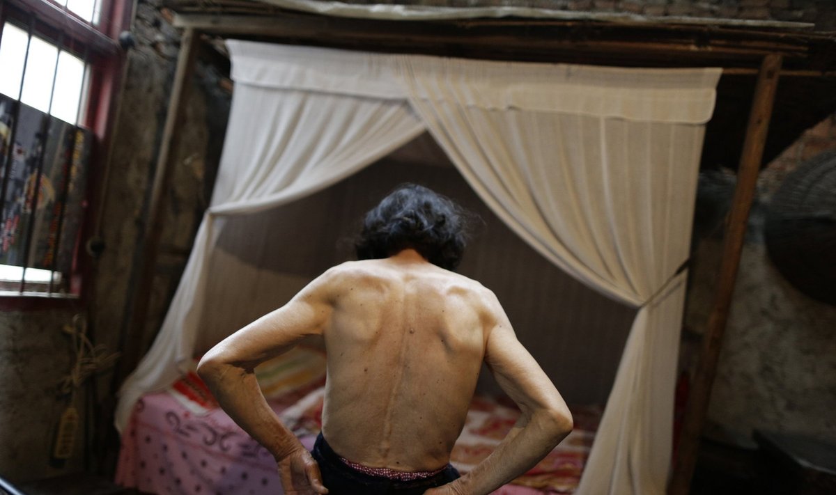 Juuni, 2014: 78-aastane Qin Zhengyu demonstreerib sünnimärke ja moodustisi oma seljal.