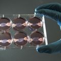 Нобелевскую премию по медицине вручили за превращение клеток в стволовые и за клонирование