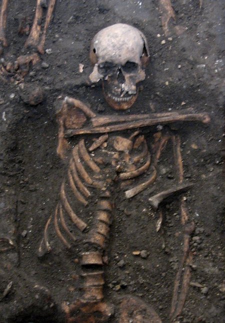 Herpest põdenud täiskasvanud Cambridge'i mehe skelett 14. sajandist.