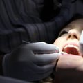 Kui hambad hakkavad suust kukkuma: mis tekitab parodontiiti ja kuidas seda ennetada?