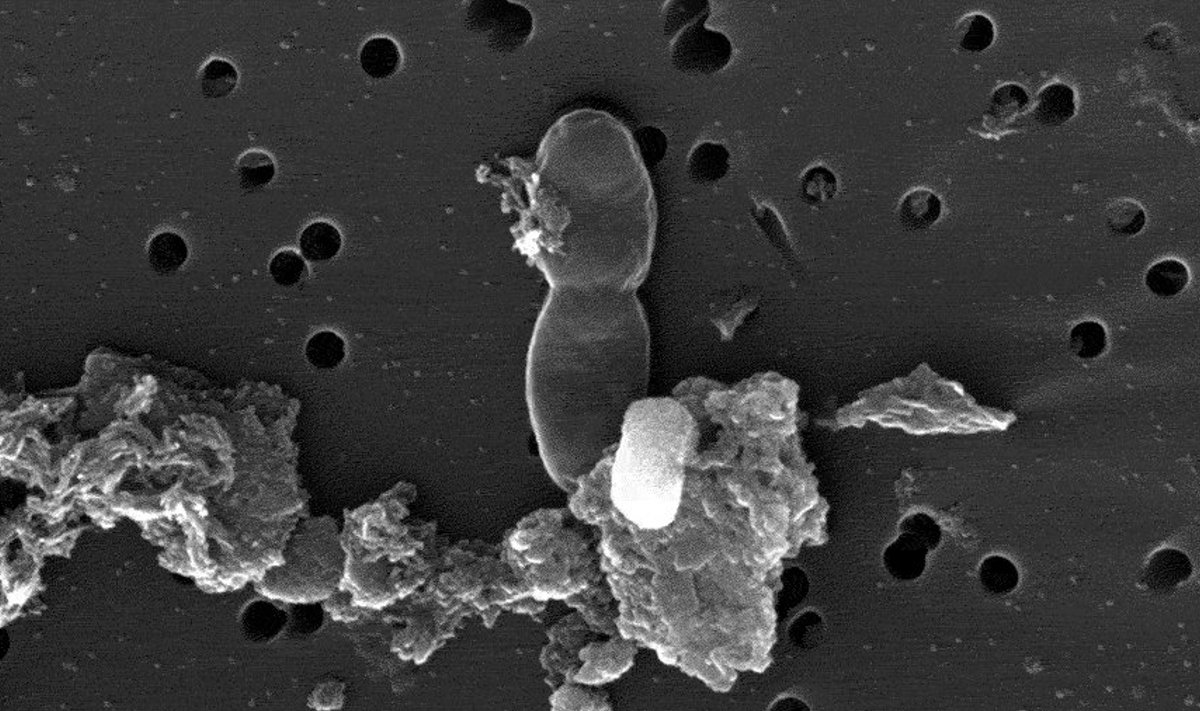 Teadlased arvavad, et elektronmikroskoobi all oli näha rakumitoosi ehk jagunemist (keskel).