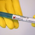 ГРАФИК | За сутки в Эстонии выявлено еще 36 зараженных коронавирусом, почти половина из них на Сааремаа. В больнице 56 человек