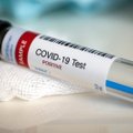 Исследование ТУ: распространение коронавируса в Эстонии более масштабное, чем следует из официальной статистики