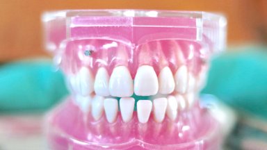 5 müüti ehk mida sa senimaani hambaid hooldades oled valesti teinud?