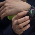 Forte kommentaar: Apple’i nutikella Watch aku on pisem kui rivaalidel (aga suurus ei loe ju)