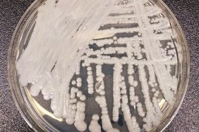 Surmavat seenpatogeeni ei ole veel Eestist leitud