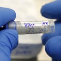 USA uurib 14 inimest, kellele võis Zika viirus üle kanduda sugulisel teel