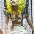 Lady GaGa põletusarmides on süüdi lokitangid