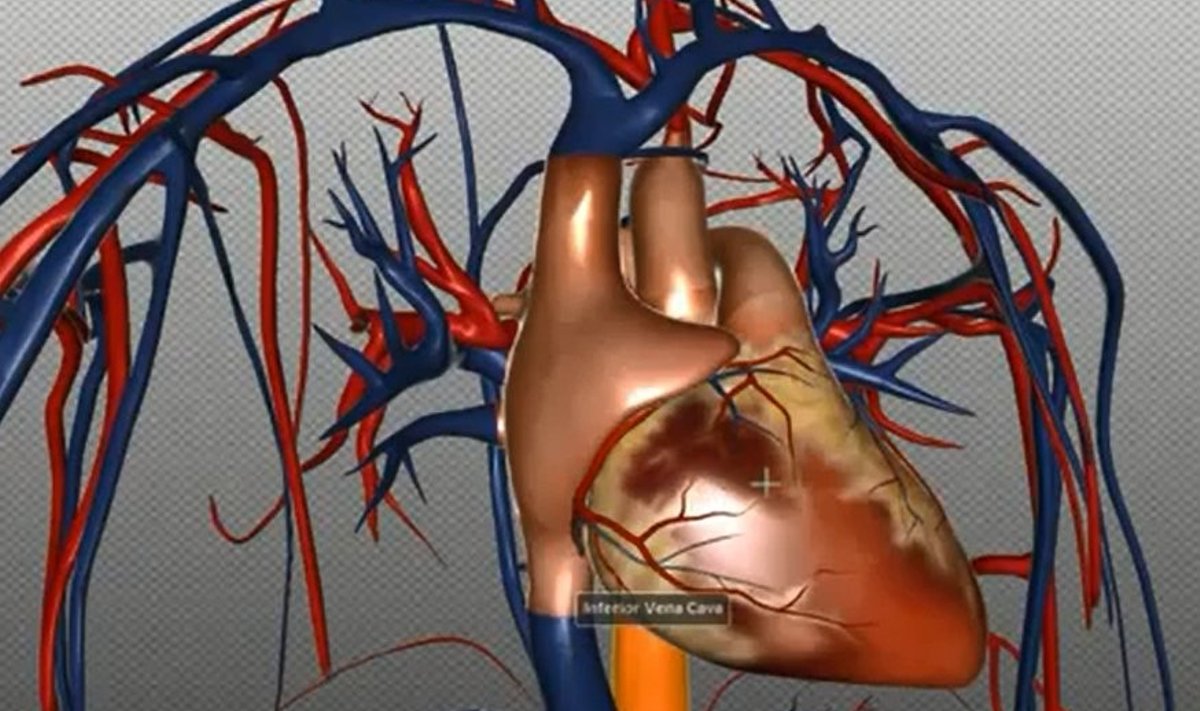 Teadlastel õnnestus südamehaiguste põhjuste üldpilti lisada uusi aspekte. 