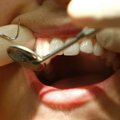 Kellele hüvitatakse hambaravi?