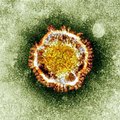 Uut tüüpi koronaviirus nõudis Saudi Araabias kolme inimese elu