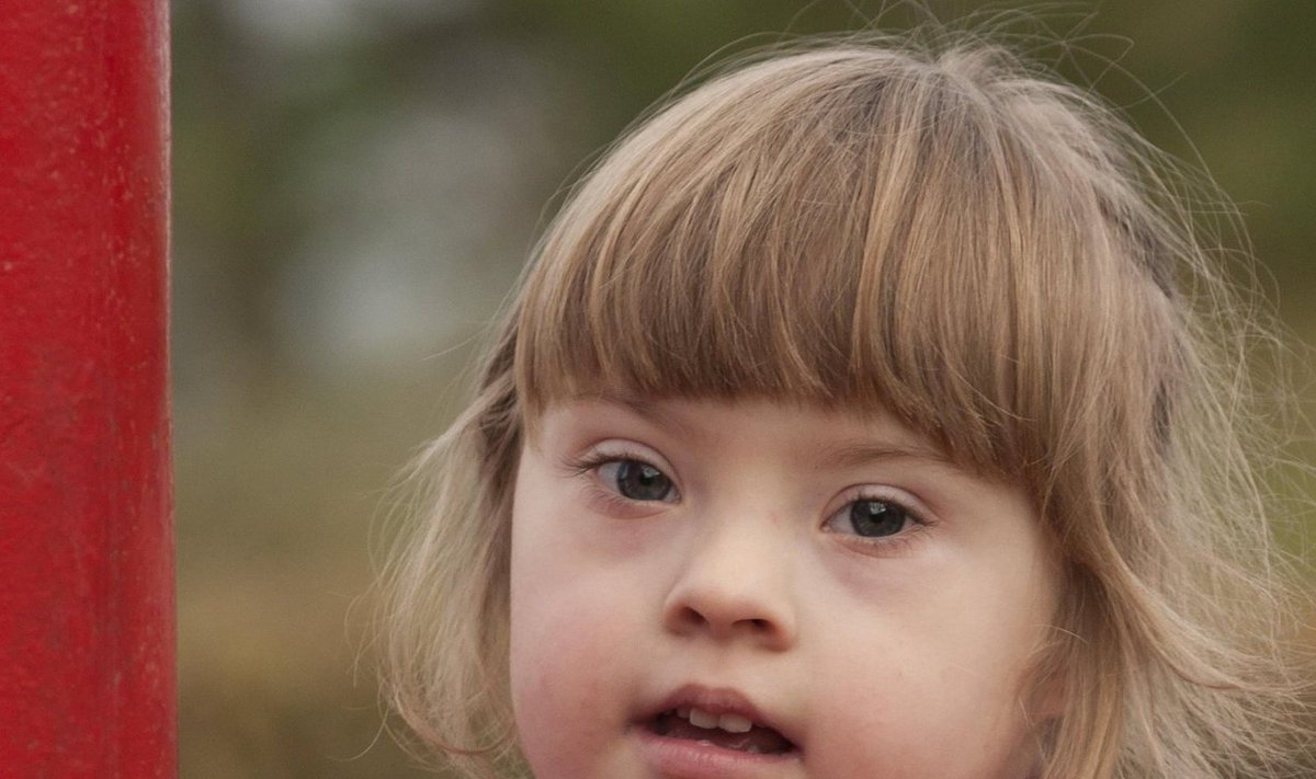 Downi sündroomiga laps