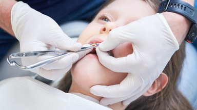 Nördinud vanemad üle Eesti: ortodontide järjekorrad küündivad aastateni. Lapsed, kes saaks täna tasuta ravi, maksavad lõpuks tuhandeid